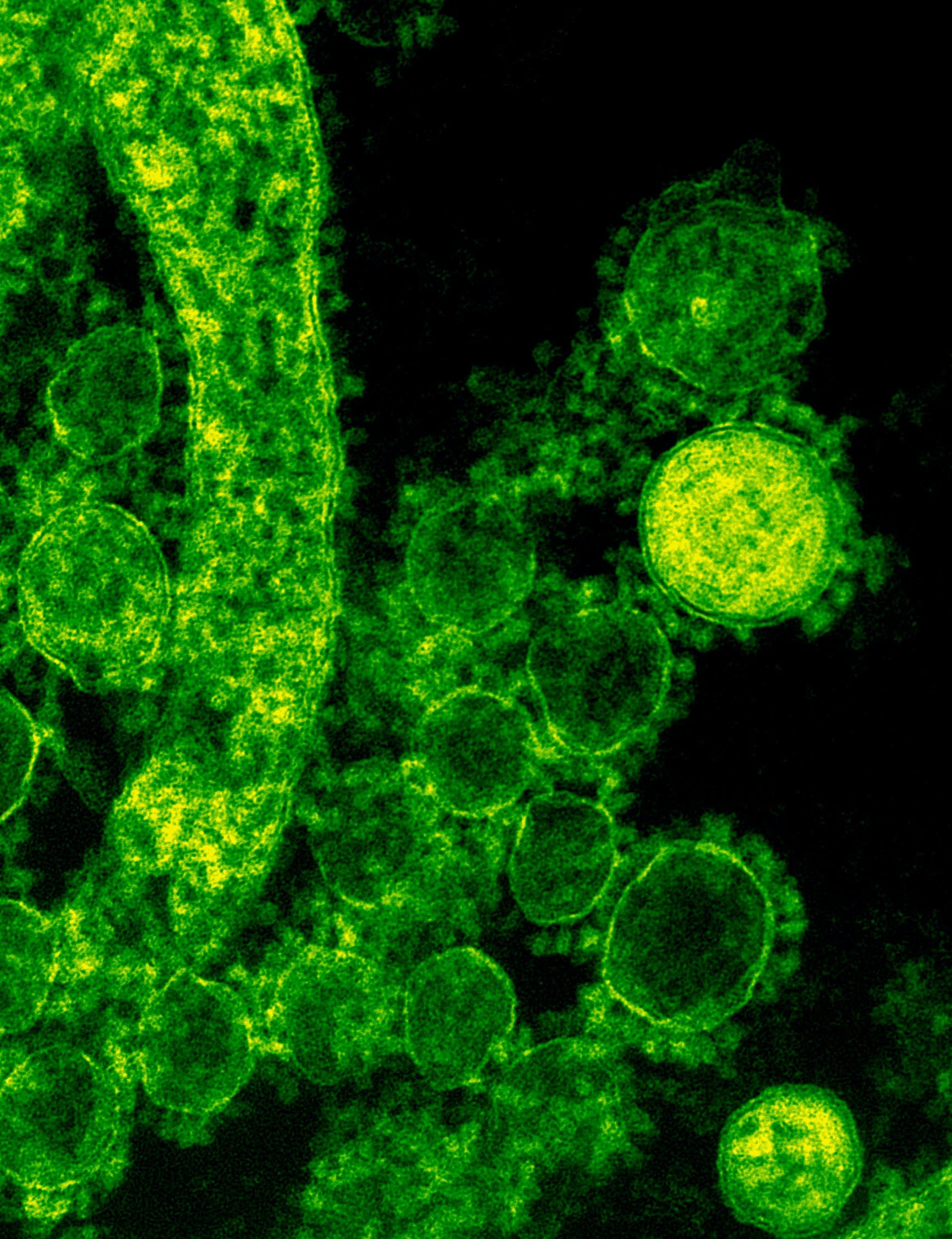 Cell Therapy